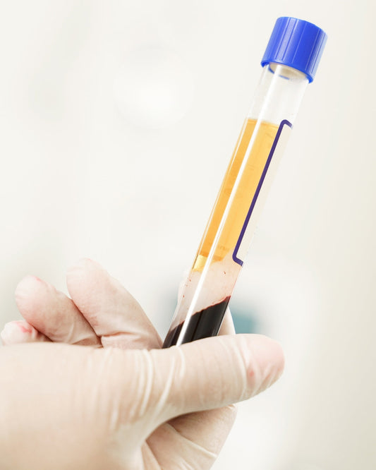 A hand holding a vial of PRP for feet