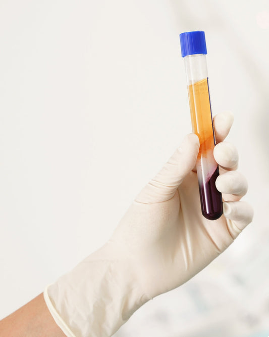 A hand wearing an exam glove holding a vial or PRP
